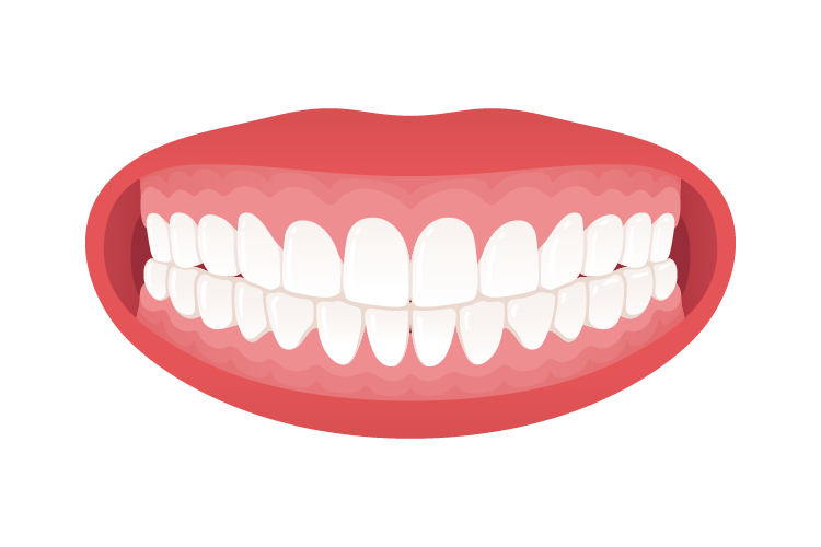 1-distalni-zagrizaj Distalni Zagrižaj - Distokluzija