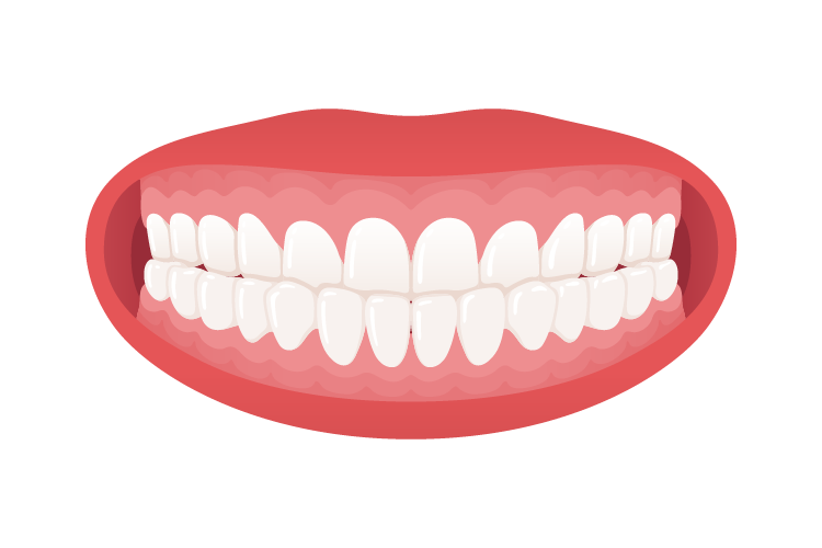 2-mezijalni-zagrizaj Mezijalni Zagrižaj - Meziokluzija