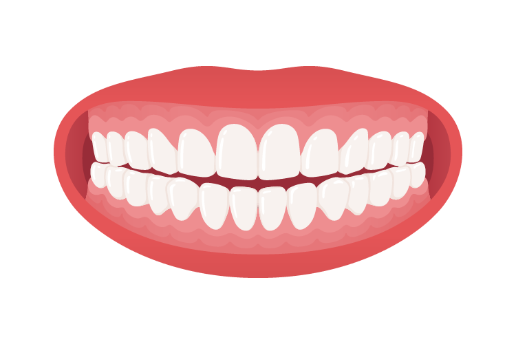 5-otvoren-zagrizaj Otvoren Zagrižaj