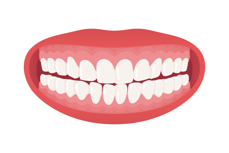 7-teskoba-zbijeni-zubi Teskoba - Zbijeni Zubi